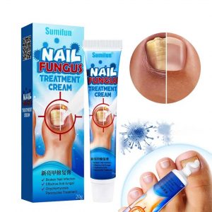 Sumifun, Крем от грибка ногтей Nail Fungus Treatment Cream, 20г